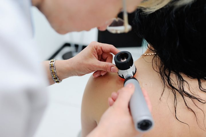 Attualità e prospettive, nella terapia del melanoma